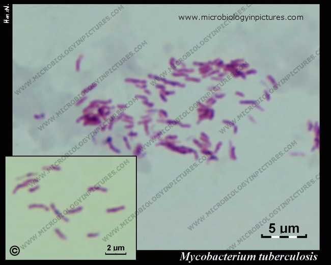 Z-N stain, acid-fast rods